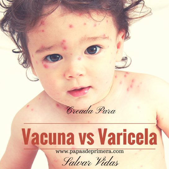 vacuna contra la varicela
