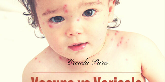 vacuna contra la varicela