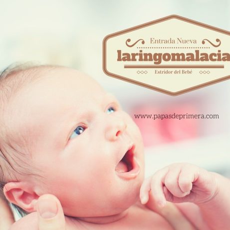 estridor, laryngomalacia