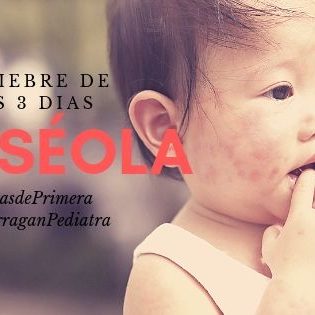 Roseola