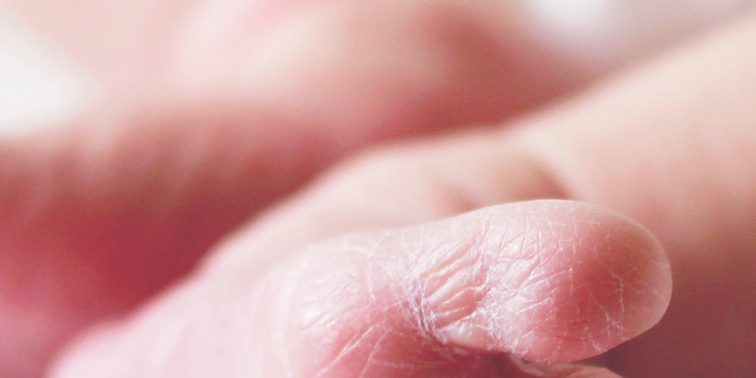 tamiz tamiz ortopedico neonatal