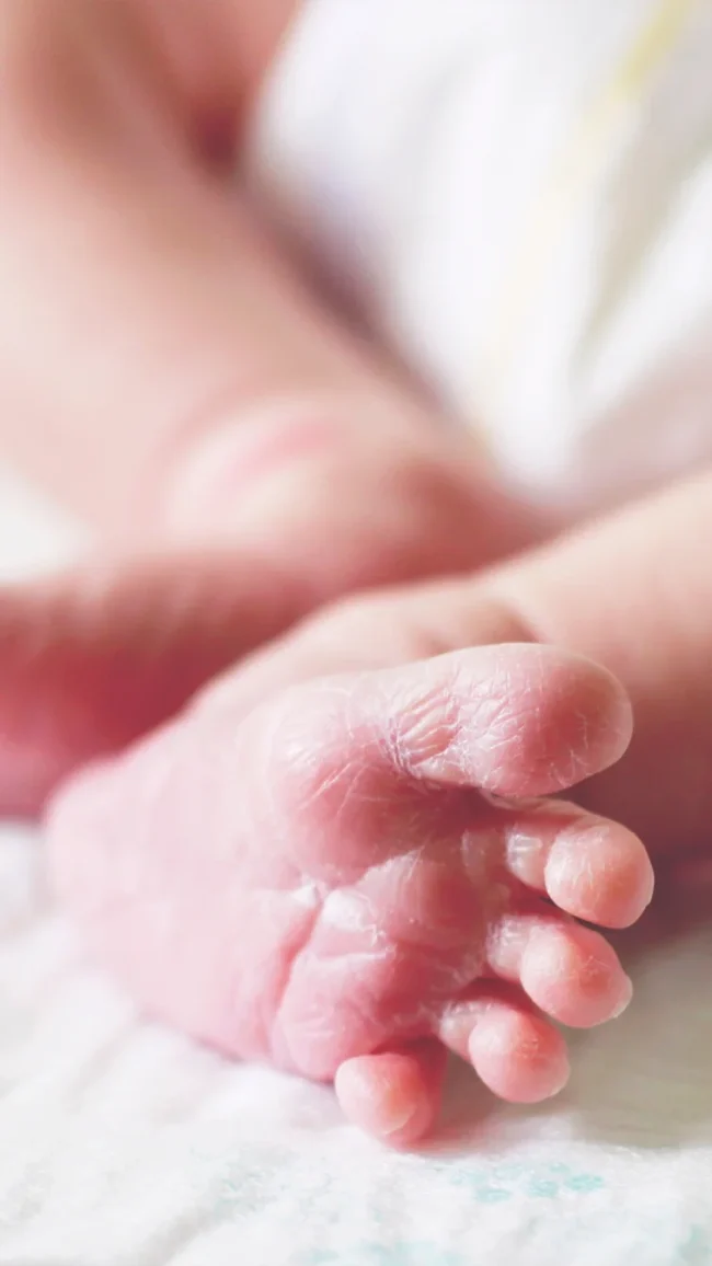 Tamiz ortopédico neonatal para detectar displasia de cadera