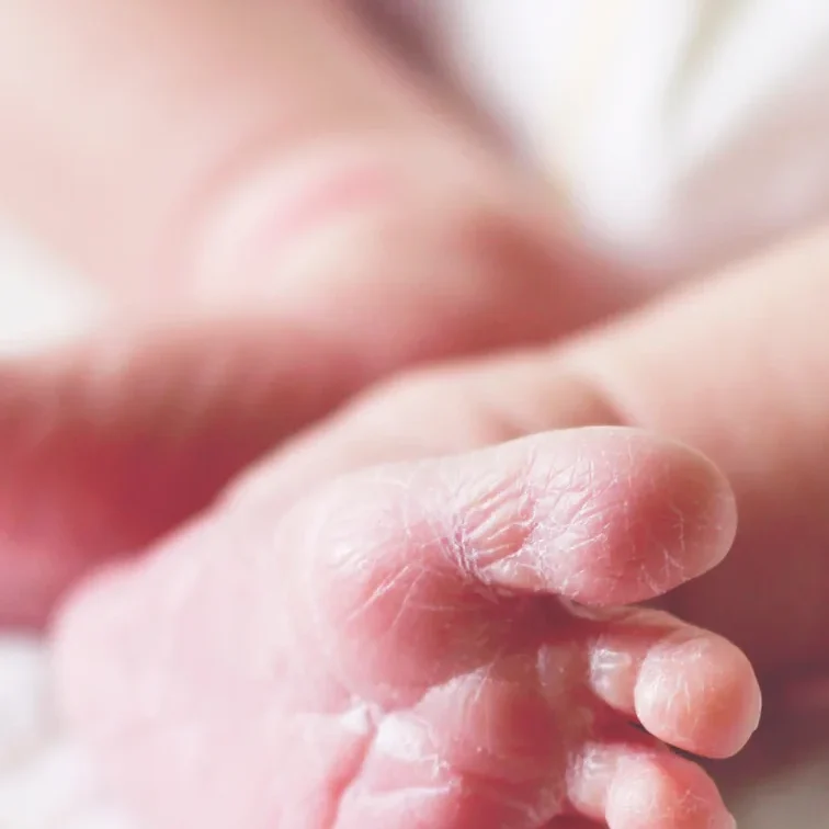 Tamiz ortopédico neonatal para detectar displasia de cadera