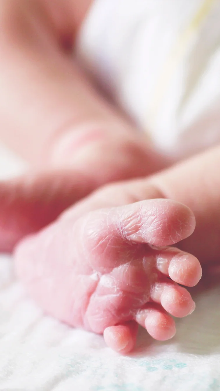 Tamiz ortopédico neonatal para detectar displasia de cadera
