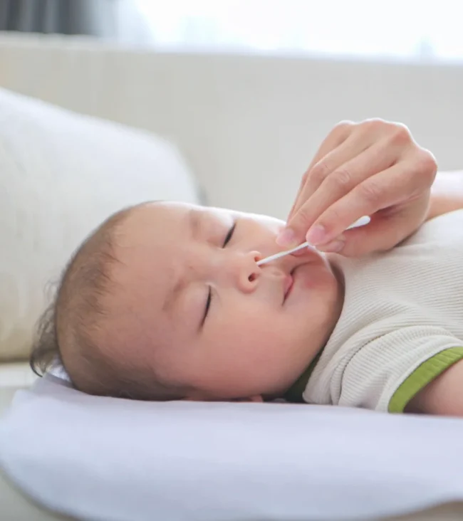 Virus sincitial respiratorio (VSR) en bebés