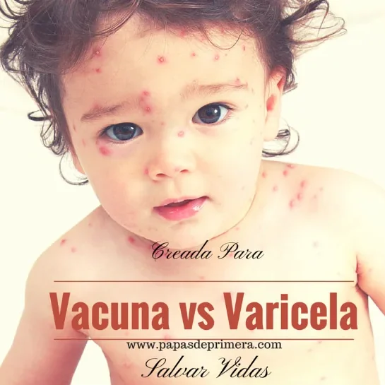 La vacuna contra la varicela