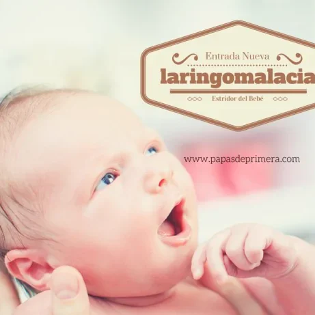 Laringomalacia en bebés