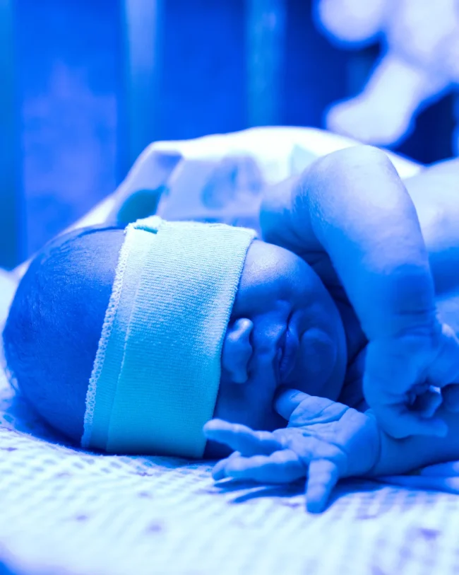 ¿Por qué mi bebé está amarillo? Todo sobre la ictericia